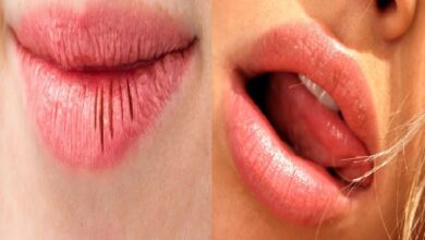 Photo of Health Tips: क्या आप भी हैं होठ फटने की समस्या से परेशान, अपनाएं ये 5 आसान उपाय