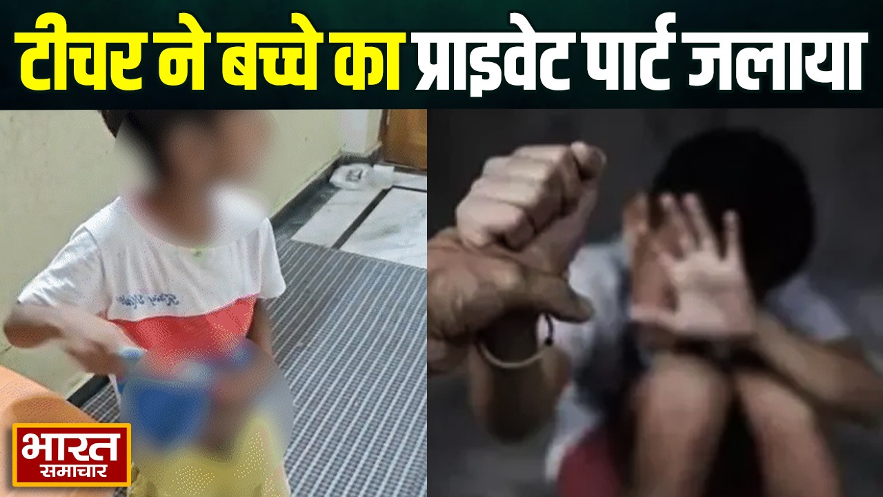 वाराणसी में हैवानियत की हदें पार ! नर्सरी के बच्चे का प्राइवेट पार्ट जलाने का आरोप, टीचर पर केस दर्ज
